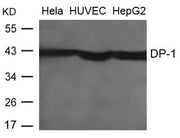 Western blot analysis of extracts from Hela, HUVEC and HepG2 cells using DP-1 Antibody.