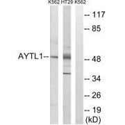 Western blot analysis of extracts from K562 cells and HT-29 cells, using LPCAT2 antibody.