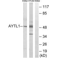 Western blot analysis of extracts from K562 cells and HT-29 cells, using LPCAT2 antibody.