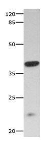 Gel: 10%SDS-PAGE Lysate: 40 ug Mouse skeletal muscle tissue lysate Primary antibody: 1/300 dilution Secondary antibody: Goat anti Rabbit IgG - H&L (HRP) at 1/10000 dilution Exposure time: 60 seconds