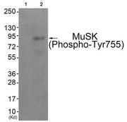Western blot analysis of extracts from JK cells (Lane 2), using MuSK (Phospho-Tyr755) Antibody. The lane on the left is treated with antigen-specific peptide.