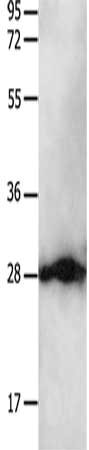 Gel: 12%SDS-PAGE, Lysate: 30 ug, Lane: Hela cells, Primary antibody: CSB-PA204913(YWHAB Antibody) at dilution 1/550, Secondary antibody: Goat anti rabbit IgG at 1/8000 dilution, Exposure time: 5 seconds
