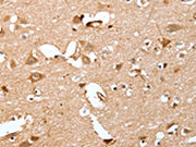 The image on the left is immunohistochemistry of paraffin-embedded Human brain tissue using CSB-PA204993(CAPG Antibody) at dilution 1/40, on the right is treated with fusion protein. (Original magnification: ×200)