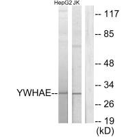 Western blot analysis of extracts from HepG2 cells and Jurkat cells, using 14-3-3 ε antibody.