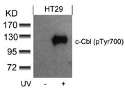Western blot analysis of extracts from HT29 cells untreated or treated with UV using c-Cbl(phospho-Tyr700) Antibody.