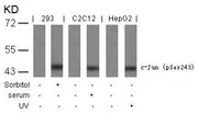 Western blot analysis of extracts from sorbitol-treated 293, Serum-treated C2C12 and UV-treated HepG2 cells using c-Jun(Phospho-Ser243) Antibody.