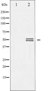 Western blot analysis of GSK3 alpha/beta expression in TNF-a treated 293 whole cell lysates,The lane on the left is treated with the antigen-specific peptide.