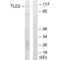 Western blot analysis of extracts from LOVO cells, using TLE2 antibody.