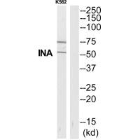 Western blot analysis of extracts from K562 cells, using INA antibody.