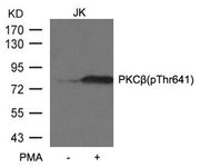 Western blot analysis of extracts from JK cells untreated or treated with PMA using PKCβ (phospho-Thr641) antibody.