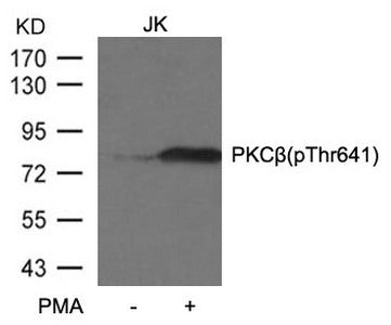 Western blot analysis of extracts from JK cells untreated or treated with PMA using PKCβ (phospho-Thr641) antibody.