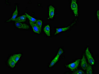 Immunofluorescent analysis of Hela cells using CSB-PA20629A0Rb at dilution of 1:100 and Alexa Fluor 488-congugated AffiniPure Goat Anti-Rabbit IgG(H+L)