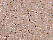 The image on the left is immunohistochemistry of paraffin-embedded Human brain tissue using CSB-PA206311(GNL3 Antibody) at dilution 1/60, on the right is treated with fusion protein. (Original magnification: ×200)