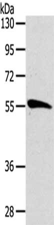 Gel: 8%SDS-PAGE,Lysate: 40 ug,,Primary antibody: CSB-PA206399(CDC25A Antibody) at dilution 1/162.5 dilution,Secondary antibody: Goat anti rabbit IgG at 1/8000 dilution,Exposure time: 3 minutes