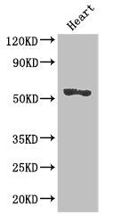 Western Blot Positive WB detected in: Mouse heart tissue All lanes: SRGAP2B antibody at 2.7ug/ml Secondary Goat polyclonal to rabbit IgG at 1/50000 dilution Predicted band size: 54 kDa Observed band size: 54 kDa