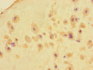 Immunohistochemistry of paraffin-embedded human placenta tissue using CSB-PA20649A0Rb at dilution of 1:100