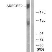 Western blot analysis of extracts from A549 cells, using ARFGEF2 antibody.