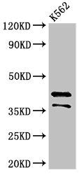 Western Blot Positive WB detected in: K562 whole cell lysate All lanes: PAX5 antibody at 3.2µg/ml Secondary Goat polyclonal to rabbit IgG at 1/50000 dilution Predicted band size: 43, 39, 36, 33, 32, 38, 35 kDa Observed band size: 43, 36 kDa
