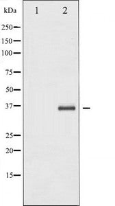 Western blot analysis of IkappaB-beta expression in TNF treated NIH-3T3 whole cell lysates,The lane on the left is treated with the antigen-specific peptide.