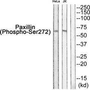 Western blot analysis of extracts from HeLa and JK using Paxillin (Phospho-Ser272) Antibody.The lane on the right is treated with the antigen-specific peptide.