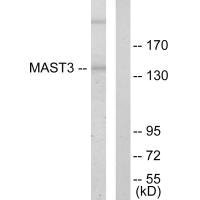 Western blot analysis of extracts from Jurkat cells, using MAST3 antibody.
