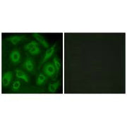 Immunofluorescence analysis of HeLa cells, using CDH23 antibody.