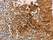 The image on the left is immunohistochemistry of paraffin-embedded Human tonsil tissue using CSB-PA207627(ADCYAP1R1 Antibody) at dilution 1/70, on the right is treated with synthetic peptide. (Original magnification: ×200)