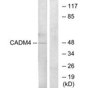 Western blot analysis of extracts from RAW264.7 cells, using CADM4 antibody.