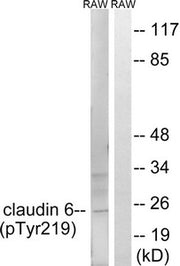 Western blot analysis of extracts from RAW264.7 cells treated with UV using Claudin 6 (Phospho-Tyr219) Antibody.The lane on the right is treated with the antigen-specific peptide.