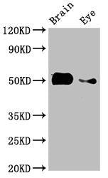Western Blot Positive WB detected in: Zebrafish brain tissue, Zebrafish eye tissue All lanes: tuba8l2 antibody at 3µg/ml Secondary Goat polyclonal to rabbit IgG at 1/50000 dilution Predicted band size: 51 kDa Observed band size: 51 kDa
