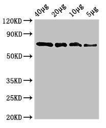Western Blot Positive WB detected in: Recombinant protein 40µg, 20µg, 10µg, 5µg All lanes: sox10 antibody at 3.4µg/ml Secondary Goat polyclonal to rabbit IgG at 1/50000 dilution Predicted band size: 73 kDa Observed band size: 73 kDa