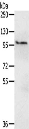 Gel: 6%SDS-PAGE,Lysate: 40 ug,,Primary antibody: CSB-PA208661(EMC1 Antibody) at dilution 1/200 dilution,Secondary antibody: Goat anti rabbit IgG at 1/8000 dilution,Exposure time: 15 seconds