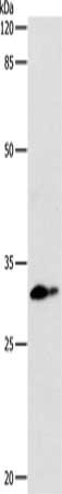 Gel: 10%SDS-PAGE, Lysate: 24 ug, Lane: Mouse lung tissue, Primary antibody: CSB-PA208971(CEBPD Antibody) at dilution 1/250, Secondary antibody: Goat anti rabbit IgG at 1/8000 dilution, Exposure time: 30 seconds