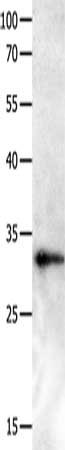 Gel: 10%SDS-PAGE, Lysate: 40 ug, Lane: Human ovarian cancer tissue, Primary antibody: CSB-PA209020(GPR3 Antibody) at dilution 1/400, Secondary antibody: Goat anti rabbit IgG at 1/8000 dilution, Exposure time: 2 minutes
