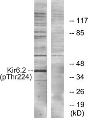 Western blot analysis of extracts from HeLa cells, using Kir6.2 (Phospho-Thr224) antibody. The lane on the right is treated with the synthesized peptide.