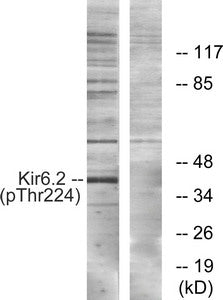 Western blot analysis of extracts from HeLa cells, using Kir6.2 (Phospho-Thr224) antibody. The lane on the right is treated with the synthesized peptide.