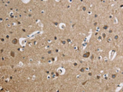The image is immunohistochemistry of paraffin-embedded Human brain tissue using CSB-PA209356(CYCS Antibody) at dilution 1/50. (Original magnification: ×200)