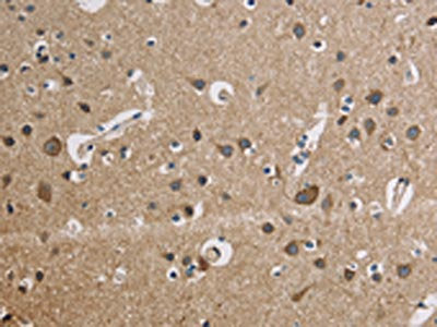 The image is immunohistochemistry of paraffin-embedded Human brain tissue using CSB-PA209356(CYCS Antibody) at dilution 1/50. (Original magnification: ×200)