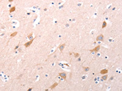 The image on the left is immunohistochemistry of paraffin-embedded Human brain tissue using CSB-PA209818(C1QTNF6 Antibody) at dilution 1/30, on the right is treated with fusion protein. (Original magnification: ×200)