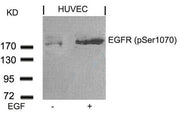 Western blot analysis of extracts from HUVEC cells untreated or treated with EGF using EGFR(Phospho-Ser1070) Antibody.