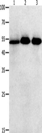 Gel: 10+12+15%SDS-PAGE, Lysate: 40 ug, Lane 1-3: Human lymphoma tissue, Human ovarian tissue, Human colon cancer tissue, Primary antibody: CSB-PA210140(KLF5 Antibody) at dilution 1/350, Secondary antibody: Goat anti rabbit IgG at 1/8000 dilution,...