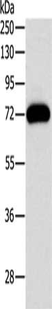 Gel: 10%SDS-PAGE, Lysate: 40 ug, Lane: Mouse brain tissue, Primary antibody: CSB-PA210184(PRKCG Antibody) at dilution 1/500, Secondary antibody: Goat anti rabbit IgG at 1/8000 dilution, Exposure time: 20 seconds