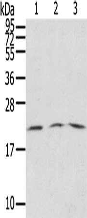 Gel: 12%SDS-PAGE, Lysate: 60 ug, Lane 1-3: A431 cells, Jurkat cells, Raji cells, Primary antibody: CSB-PA210351(SSX5 Antibody) at dilution 1/200, Secondary antibody: Goat anti rabbit IgG at 1/8000 dilution, Exposure time: 30 seconds
