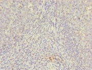 Immunohistochemistry of paraffin-embedded human tonsil tissue using CSB-PA2105ESR1HU at dilution of 1:100