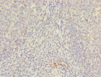 Immunohistochemistry of paraffin-embedded human tonsil tissue using CSB-PA2105ESR1HU at dilution of 1:100