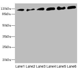 Western blot All lanes: PCDH1 antibody at 2.56ug/ml Lane 1: A431 whole cell lysate Lane 2: Human breast cancer cell Lane 3: Jurkat whole cell lysate Lane 4: Hela whole cell lysate Lane 5: NIH/3T3 whole cell lysate Lane 6: 293T whole cell lysate Se...