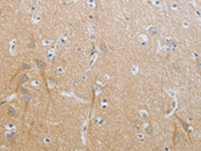 The image on the left is immunohistochemistry of paraffin-embedded Human brain tissue using CSB-PA210767(TNFRSF11B Antibody) at dilution 1/20, on the right is treated with fusion protein. (Original magnification: ×200)