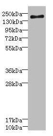 Western blot All lanes: SCN7A antibody at 2.36µg/ml + Jurkat whole cell lysate Secondary Goat polyclonal to rabbit IgG at 1/10000 dilution Predicted band size: 194 kDa Observed band size: 194 kDa
