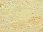 Immunohistochemistry of paraffin-embedded human heart tissue using CSB-PA2108ESR2HU at dilution of 1:100