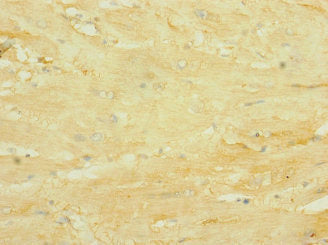 Immunohistochemistry of paraffin-embedded human heart tissue using CSB-PA2108ESR2HU at dilution of 1:100